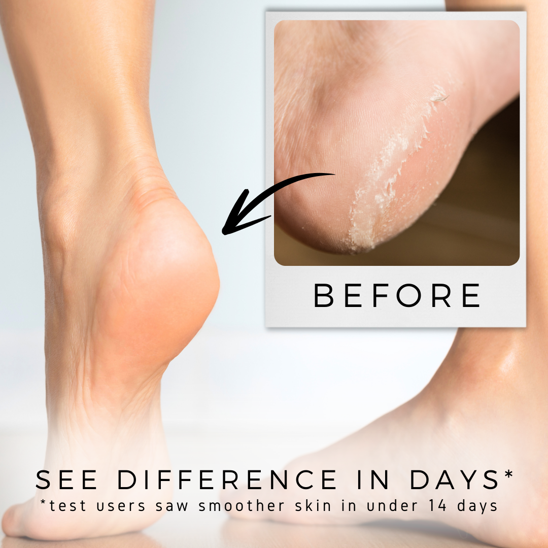 Repair + Soothe Magnesium Foot Cream